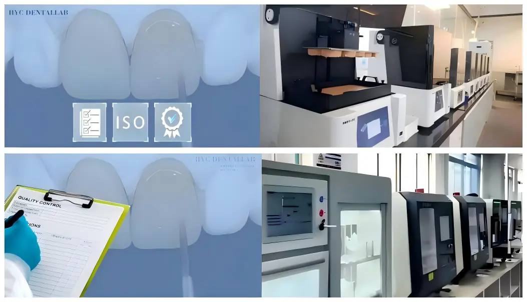 Ceramic-Fused-to-Zirconia