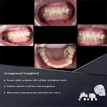 Metal-Free Aesthetic Framework