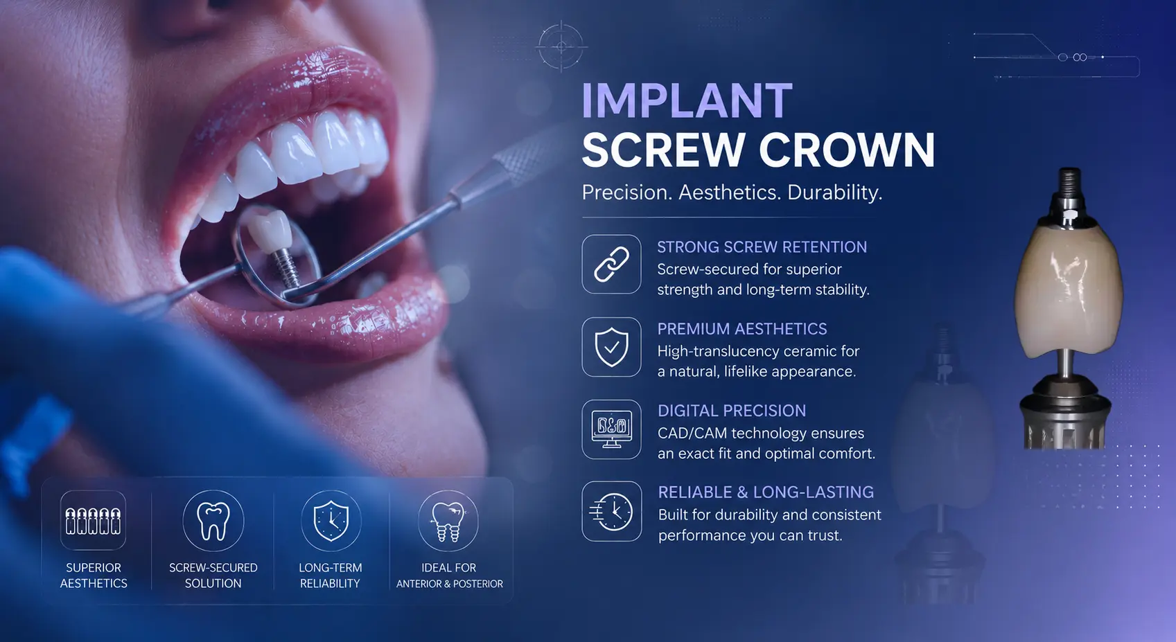 Implant Screw Crown Implant Screw Crown