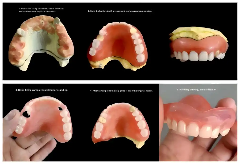 Valplast Dentures