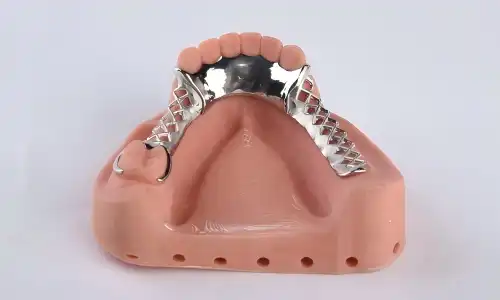 Why Choose Metal Chrome Partial Framework for Long-Term Denture Use?